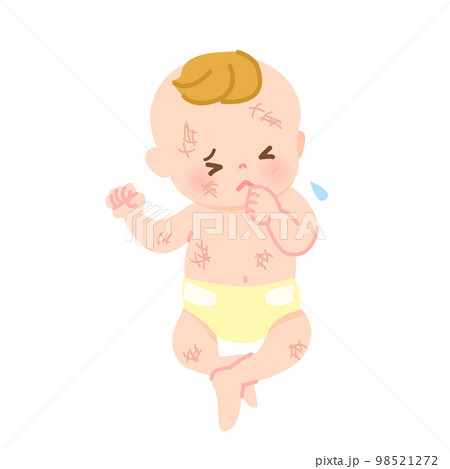 肌荒れしている赤ちゃんのイラスト素材_全身 98521272