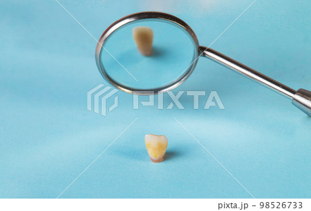 dental mirror and milk baby tooth on a blue background. The concept of pediatric dental surgery. Close-up dental mirror and milk baby tooth on a blue background. The concept of pediatric dental surgery. Close-up 98526733