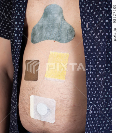 Many different medical plasters are glued on the human body. Anti-inflammatory, fat burning and anti-smoking. The concept of treatment with patches in medicine. 98527239