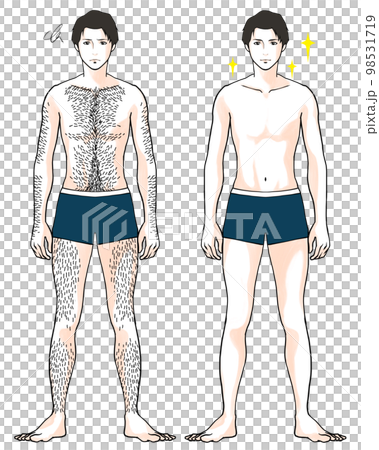 体毛が多い男性のビフォーアフターのイラスト 体毛が多い男性のビフォーアフターのイラスト 98531719