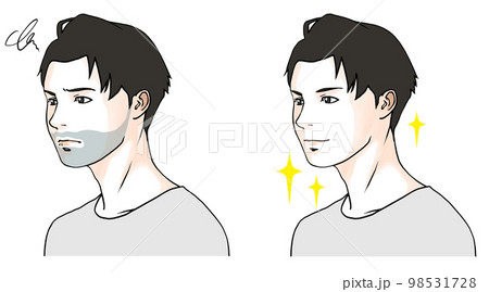 青ひげに悩む男性のビフォーアフターのイラスト 98531728