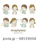 アナフィラキシーショックの症状が出ている男女 98539008