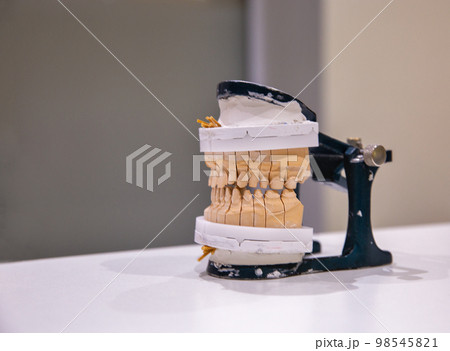 Manufacturing of a human permanent ceramic-metal dental prosthesis on implants Manufacturing of a human permanent ceramic-metal dental prosthesis on implants 98545821