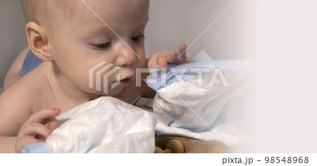 a baby with a hemangioma on his neck lies on a white background 98548968