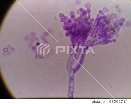 光学顕微鏡で拡大した分生子 光学顕微鏡で拡大した分生子 98565714