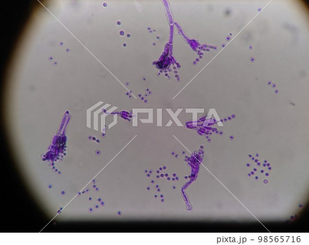 ペニシリン㈱の分生子 ペニシリン㈱の分生子 98565716