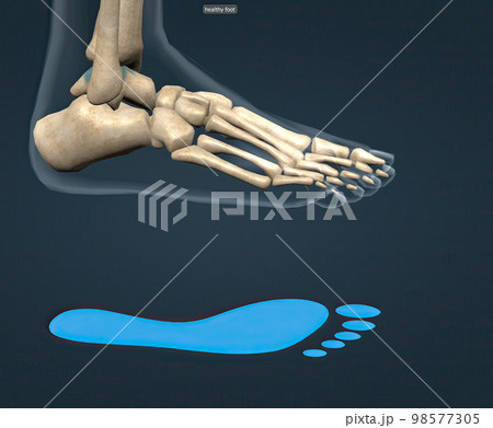 Healthy foot skeleton and blue footprint Healthy foot skeleton and blue footprint 98577305