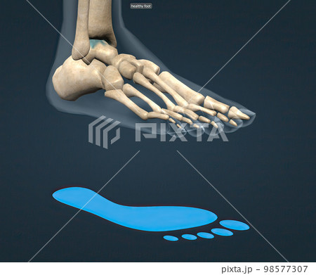 Healthy foot skeleton and blue footprint 98577307
