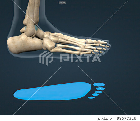 Flat feet is a common condition in which the arches on the inside of the feet flatten when pressure is applied to them. 98577319