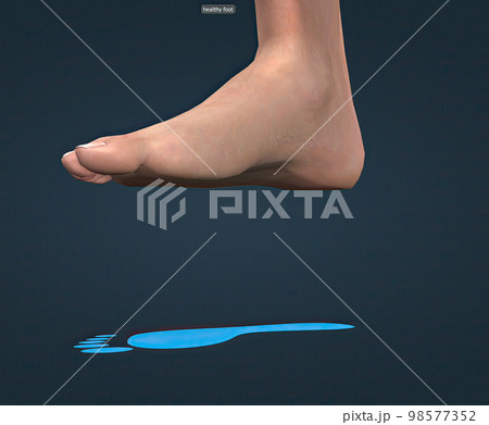 Healthy foot and blue footprint 98577352
