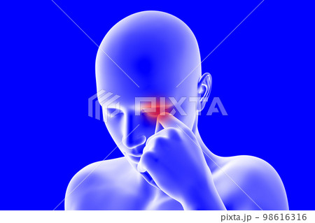 目がかゆく手で掻いている人のCGイラスト 98616316