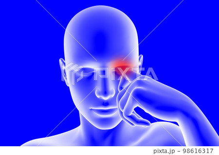 目がかゆく手で掻いている人のCGイラスト2 98616317