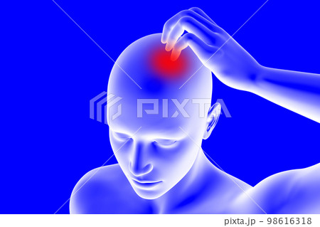 頭がかゆく手で掻いている人のCGイラスト 98616318