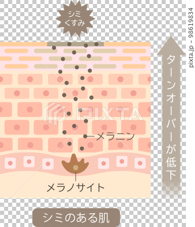 シミのできる肌のしくみ　ターンオーバー　肌細胞　ビフォアアフター 98619834