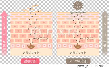 Mechanism of blemished skin Turnover Skin cells Before and after 98619835