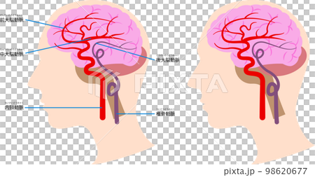 脳内の血管の図解 98620677