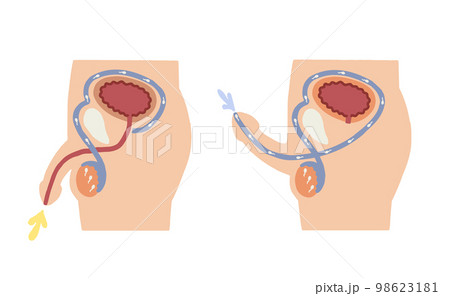 男性生殖器 射精のしくみ ベクターイラスト 男性生殖器 射精のしくみ ベクターイラスト 98623181