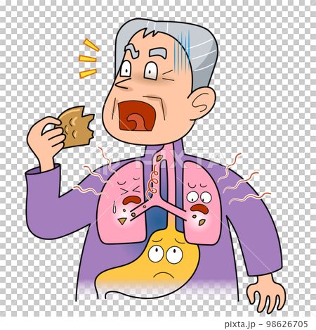 誤嚥-肺に異物が侵入する 誤嚥-肺に異物が侵入する 98626705