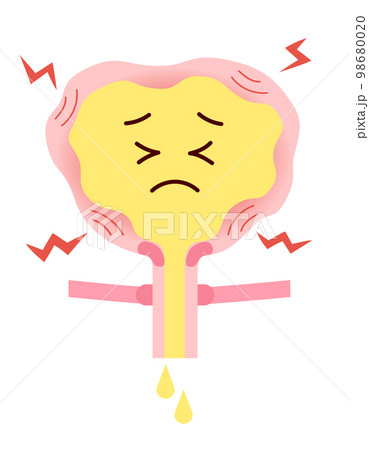 尿が我慢できない頻尿の膀胱のイラスト 尿が我慢できない頻尿の膀胱のイラスト 98680020