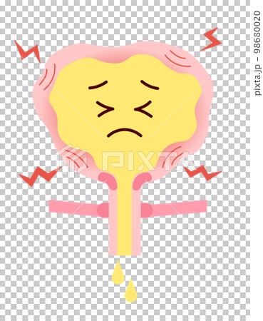 尿が我慢できない頻尿の膀胱のイラスト 尿が我慢できない頻尿の膀胱のイラスト 98680020