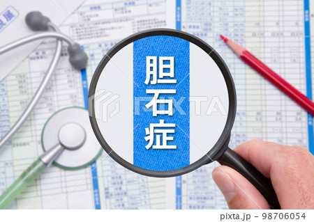 胆石症 胆石症 98706054