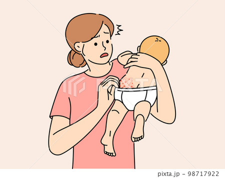 Anxious young mother confused with baby body rash 98717922