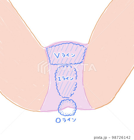 VIO 図解 下着あり VIO 図解 下着あり 98726142