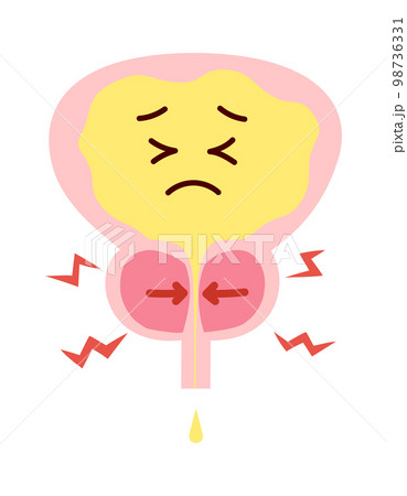 前立腺肥大で苦しそうな膀胱のイラスト 98736331