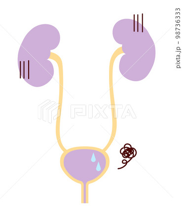 調子が悪い腎臓と膀胱のシンプルなイラスト 調子が悪い腎臓と膀胱のシンプルなイラスト 98736333