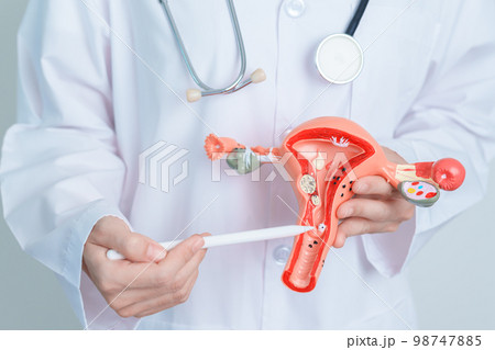 Doctor holding Uterus and Ovaries model. Ovarian and Cervical cancer, Cervix disorder, Endometriosis, Hysterectomy, Uterine fibroids, Reproductive system and Pregnancy concept Doctor holding Uterus and Ovaries model. Ovarian and Cervical cancer, Cervix disorder, Endometriosis, Hysterectomy, Uterine fibroids, Reproductive system and Pregnancy concept 98747885