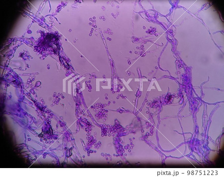 冷蔵庫のパッキンに生えていたカビ 98751223