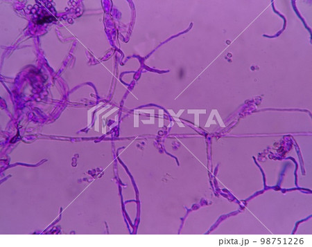 冷蔵庫のパッキンに生育していたクロカビ 98751226