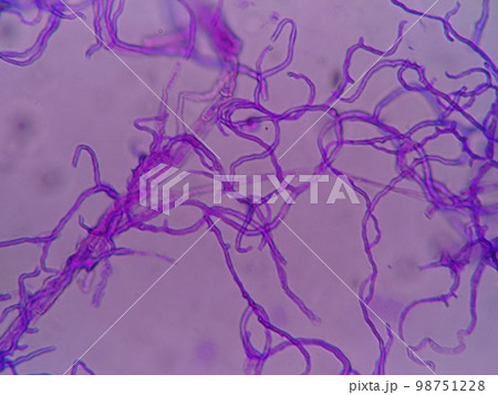 冷蔵庫のパッキンに生育していたクロカビ 98751228