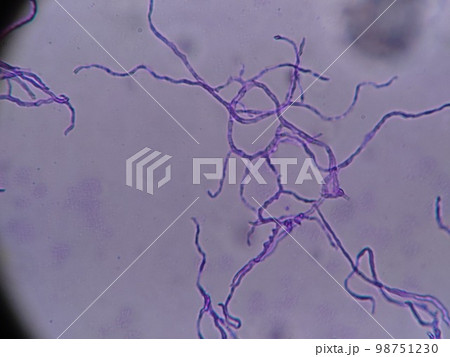 冷蔵庫のパッキンに生育していたクロカビ 冷蔵庫のパッキンに生育していたクロカビ 98751230