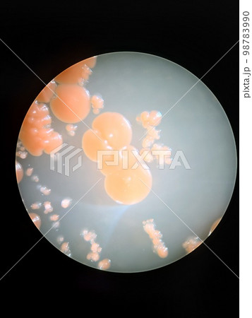 シャーレにコンタミネーション シャーレにコンタミネーション 98783990