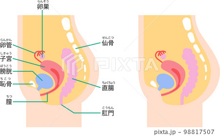女性の下腹部の内臓を側面から図解したイラスト 98817507