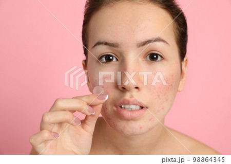 Teen girl applying acne healing patch on light pink background 98864345