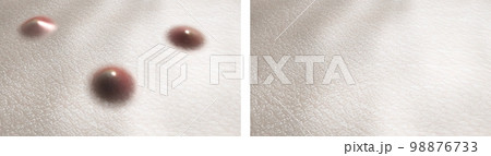 Skin with acne before and after treatment. Medical 3d rendered illustration set Skin with acne before and after treatment. Medical 3d rendered illustration set 98876733