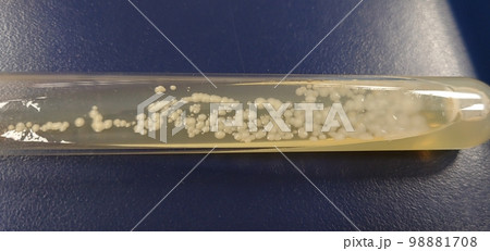 酵母菌の保存試験管 酵母菌の保存試験管 98881708