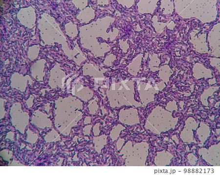 納豆菌のグラム染色顕微鏡写真 納豆菌のグラム染色顕微鏡写真 98882173