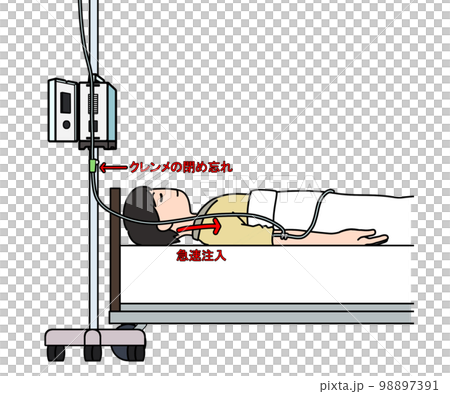 Free flow phenomenon of infusion pump 98897391