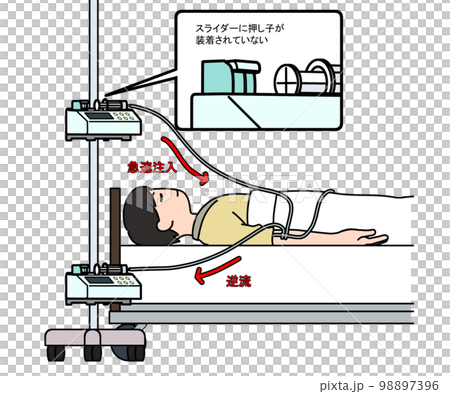 Syringe pump siphoning phenomenon 98897396