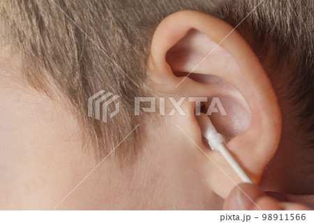 Cleaning the ear with a cotton swab. The process of cleaning the ears close-up, yellow cotton swab with dirt from the ear. Mother cleaning baby's ear, with copy space 98911566
