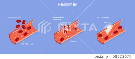 3D Isometric Flat Vector Conceptual Illustration of Hemostasis 98925676