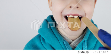 Blond boy has a yellow tongue. Painful yellow coating on the mucous membrane of the tongue. Diseases of the gastrointestinal tract, liver and gallbladder. The consequences of taking antibiotics. 98942387