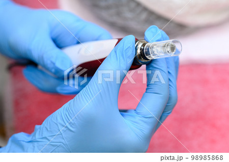 Preparation of dermapen for the rejuvenation procedure. Preparation of dermapen for the rejuvenation procedure. 98985868
