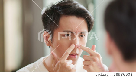 man worry his skin 98986902