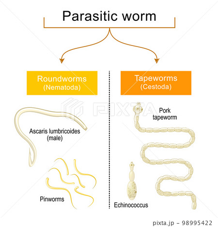 worm infection. Helminthiasis. Common types of parasitic worms or helminths 98995422
