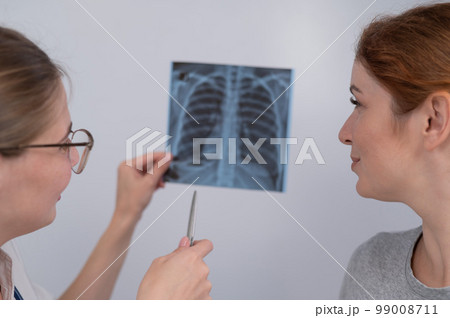 The doctor consults a caucasian woman and comments on the x-ray of the lungs.  99008711