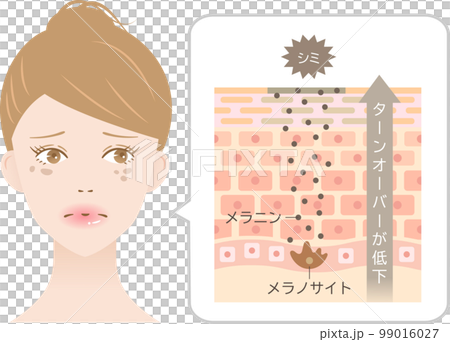 皮膚瑕疵周轉和女性橫截面和細胞 99016027